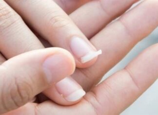 Móng giòn, dễ gãy