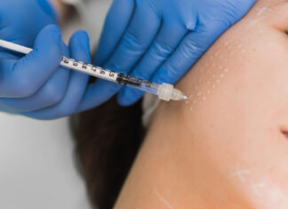 Chi tiết cách chăm sóc da sau meso để có được làn da căng bóng như ý