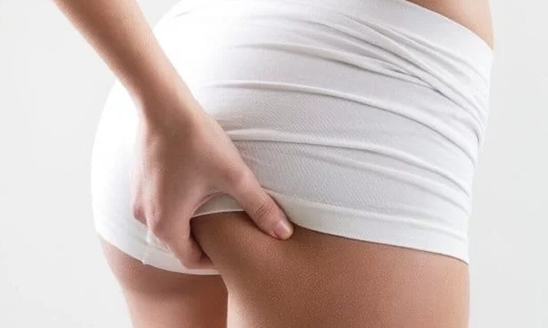 Mụn ở mông Mụn ở mông