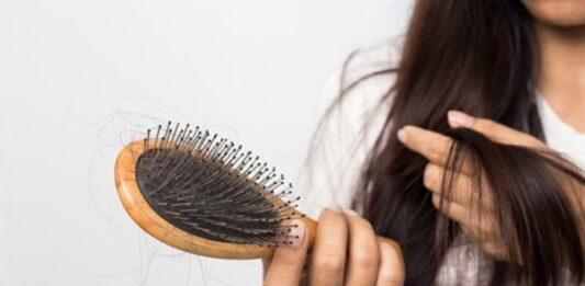 Rụng tóc từng mảng