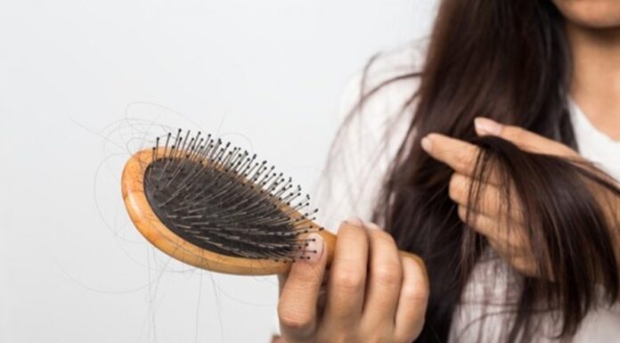 Rụng tóc từng mảng