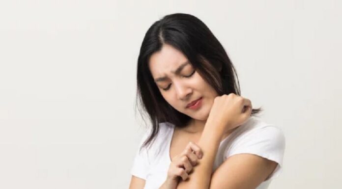 8 thói quen làm bệnh chàm trầm trọng hơn và cách khác phục 8 thói quen làm bệnh chàm trầm trọng hơn