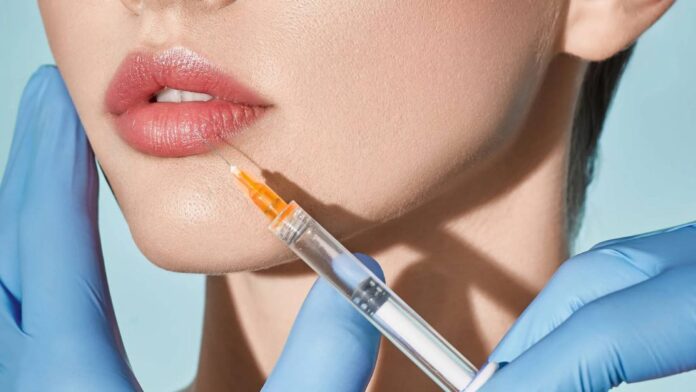 Hiểu về quá trình tiêm filler môi