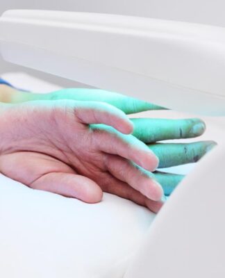 Với những trường hợp vảy nến từ trung bình đến nặng, liệu pháp ánh sáng có thể mang lại hiệu quả đáng kể