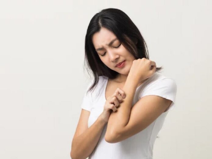 Da khô là nguyên nhân phổ biến nhất gây ngứa