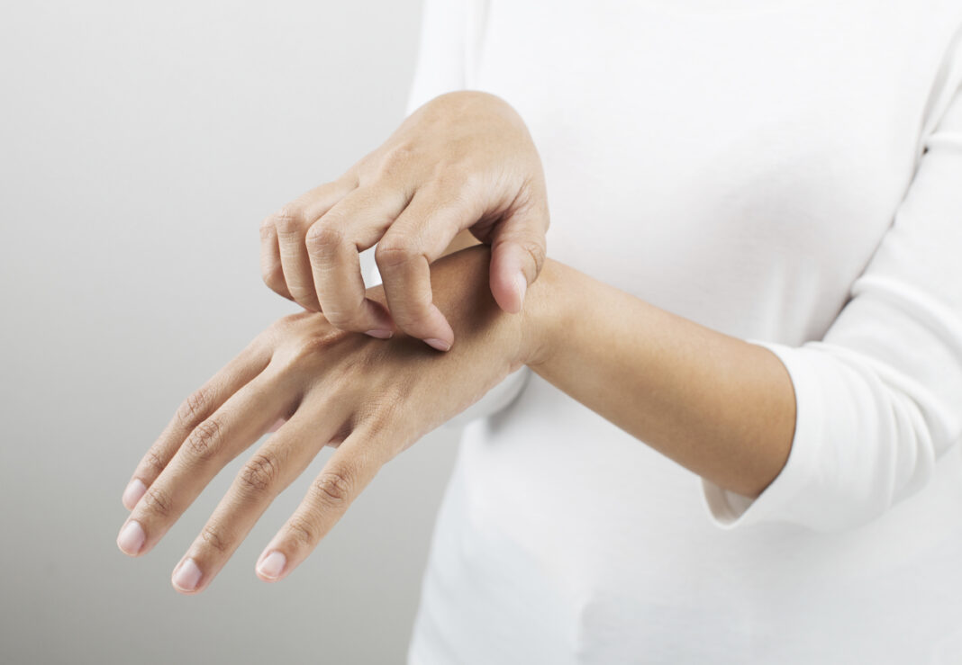Một số bệnh nhiễm trùng ngoài da cũng có thể gây ngứa toàn thân