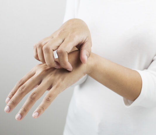 Ngứa khắp người? 10+ nguyên nhân phổ biến và cách cải thiện Một số bệnh nhiễm trùng ngoài da cũng có thể gây ngứa toàn thân