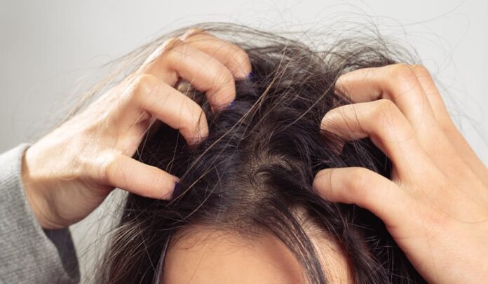 Một trong những nguyên nhân phổ biến nhất gây ngứa da đầu là phản ứng với các sản phẩm chăm sóc tóc