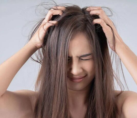 Mụn trên da đầu