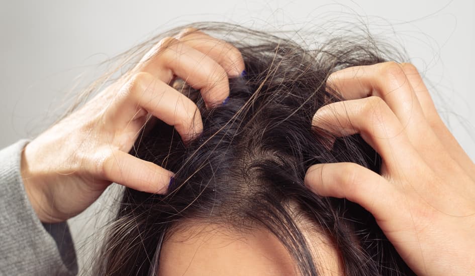 10 nguyên nhân gây ngứa da đầu phổ biến và cách cải thiện hiệu quả