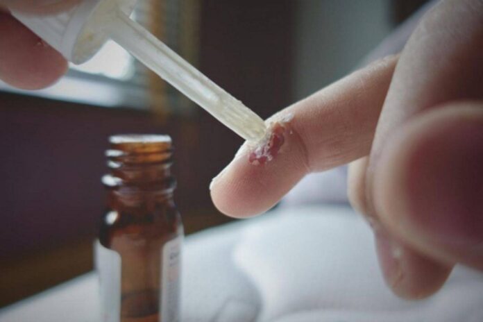 Sử dụng axit salicylic
